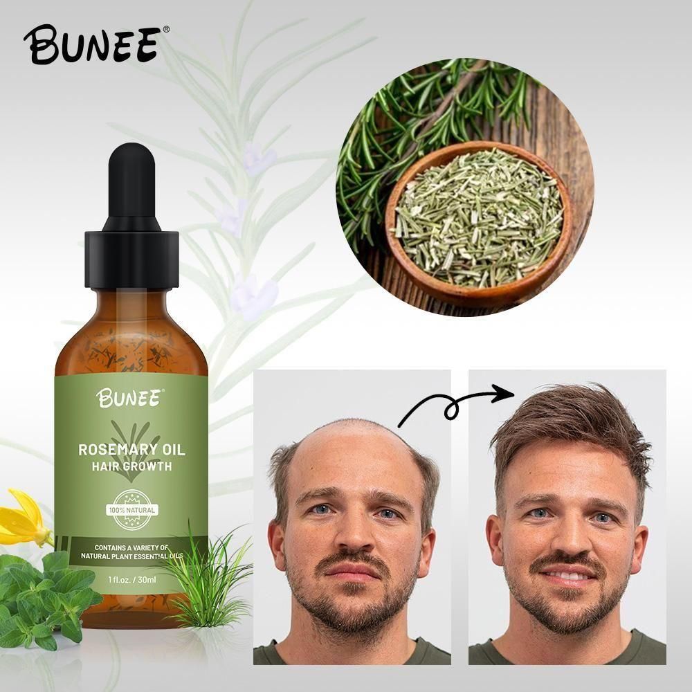 BUNEE® Rosemary Hair Growth Serum 30 ML(Pack of 1/2/3)
