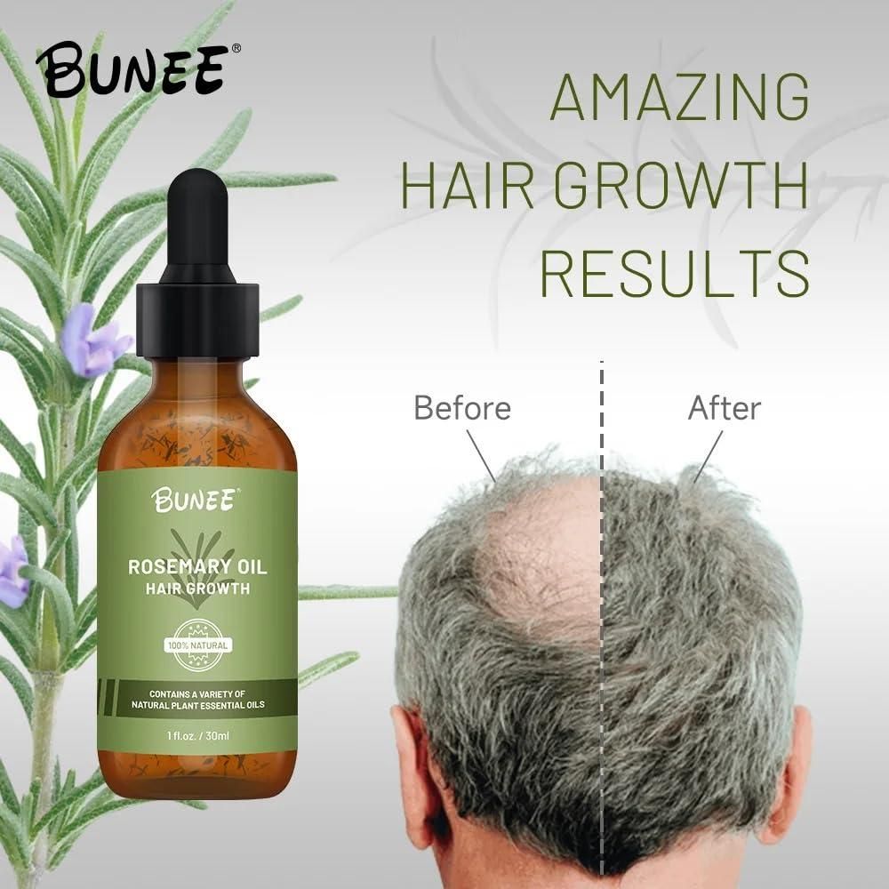 BUNEE® Rosemary Hair Growth Serum 30 ML(Pack of 1/2/3)
