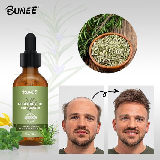 BUNEE® Rosemary Hair Growth Serum 30 ML(Pack of 1/2/3)